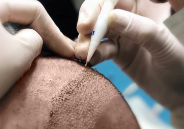 What is the DHI Method?